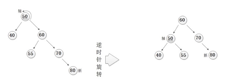 平衡二叉树-RR型